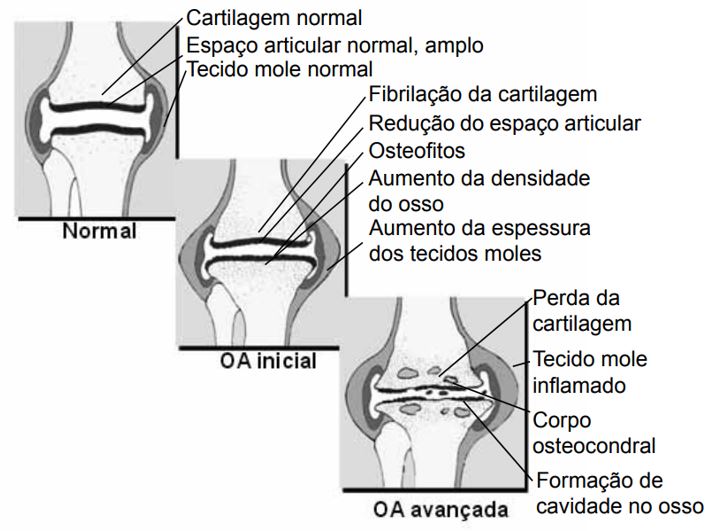 Figura 1